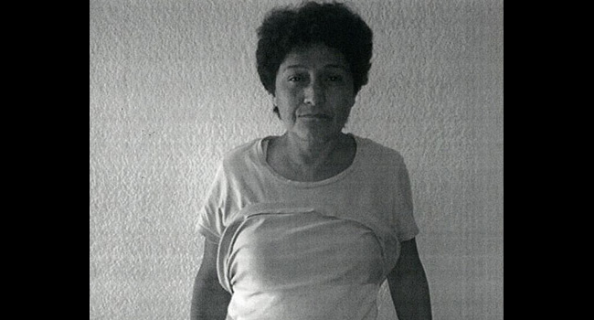 Adela recibió su equipo de colostomía